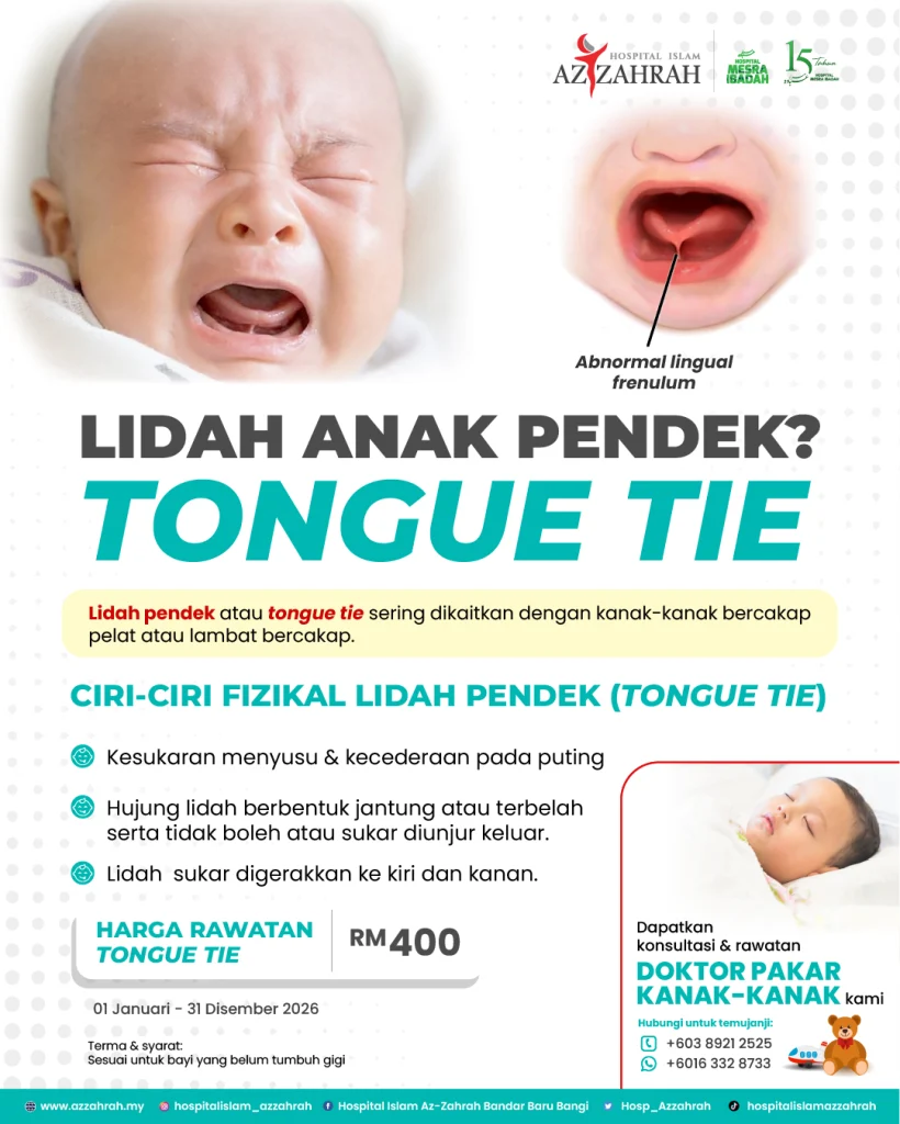 Bayi dengan masalah tongue tie atau lidah pendek